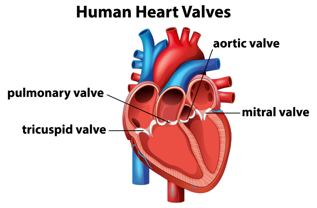 Heart valve disease diagram.