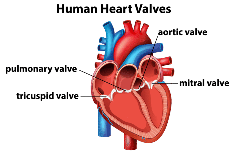 Heart valve disease diagram.