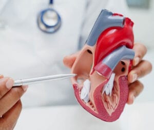 Afib - Cardiologist demonstrating heart anatomy model