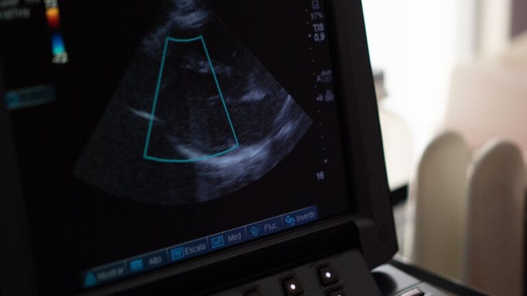 Cardiac ultrasound monitor displaying an echocardiogram image