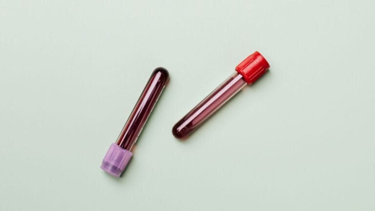 Two blood sample tubes on a pale green background